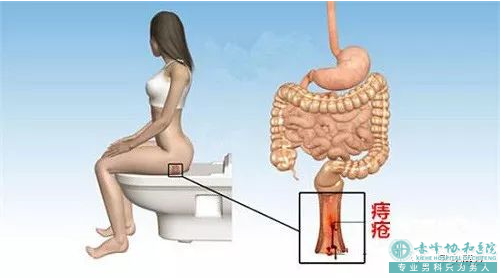 大连开发区元宝山区“屁股长疙瘩”是痔疮吗